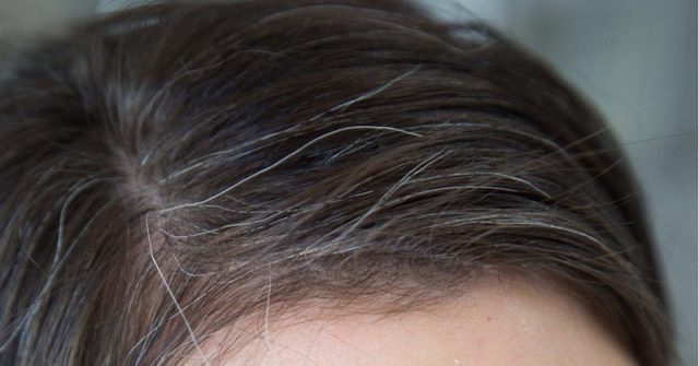 Ayurvedic Treatment for Gray Hair - Sreepathy Ayurveda